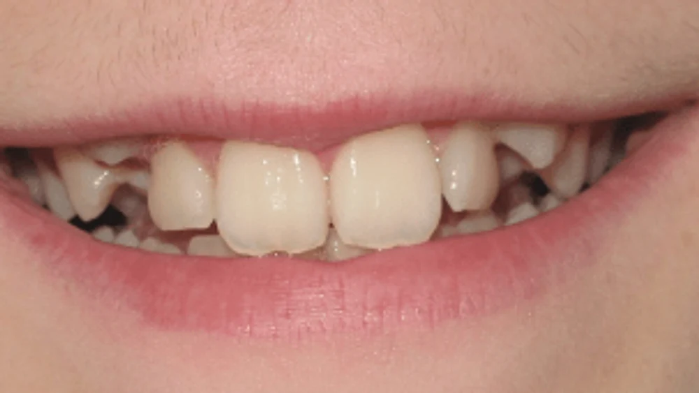Odontopediatria · Abans